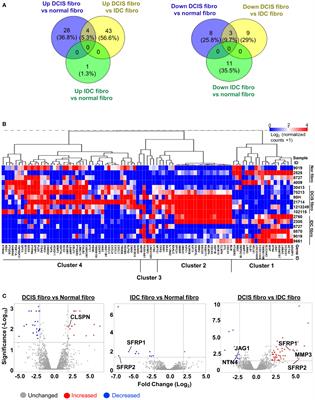Transcriptome analysis reveals differences in cell cycle, growth and migration related genes that distinguish fibroblasts derived from pre-invasive and invasive breast cancer